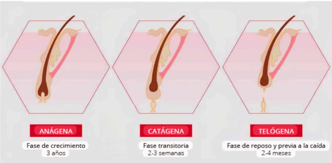 caida-del-pelo-en-hombres